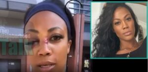 What Happened To Kim Glass? The Volleyball Olympian Allegedly Attacked By A Homeless Man With A Metal