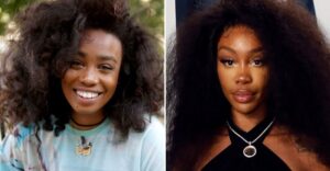 Did SZA Undergo A Plastic Surgery? See The Singer's Before and After (With Pictures)￼
