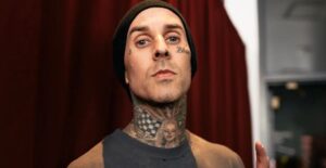 What Happened To Travis Barker's Finger? Details On His Injury