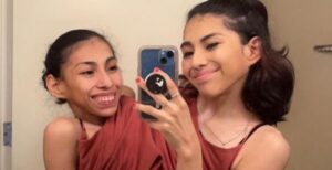 Who's Carmen Andrade's Boyfriend? This Conjoined Twins TikTok Stars With 1 Vagina Don't Share A Partner